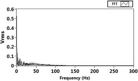 Figure 4 : The results of removing power line interference 50 Hz. a)Clean ECG signal; b) ECG signal contaminated by power line noise with 0.4 mV magnitude; c) recovered ECG signal using proposed Algorithm; d)recovered ECG signal using MLS Algorithm; e) recovered ECG signal using NLMS Algorithm
