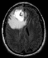 Figure 4: Conversion to binary Image