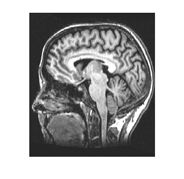Where, Feedback R1 = 1M? Low-Pass filter R2 = 100?, C1 = 4 µF c) Hardware implementation The hardware implementation has done in both mechanical & electronics parts. Those three control box shown in Fig.6 consist of electronics parts. That includes Microcontroller, assembly of Relay, Bluetooth module, GSM (Global System for Mobile Communication) module circuitry. After receiving commands, microcontroller initiates ports to operate the Relay.