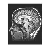 Fig. 3: Coordinate system for motion controlled interface.