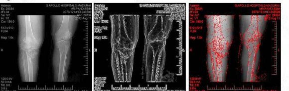 Figure 2 : Modules in MapReduce Function